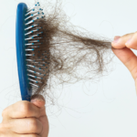 The-Only-Thing-You-Haven’t-Tried-to-Avoid-Hair-Fall
