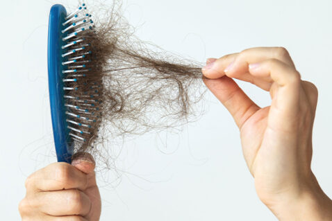 The-Only-Thing-You-Havent-Tried-to-Avoid-Hair-Fall